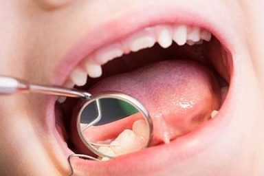 What’s So Special About Pediatric Dentists?