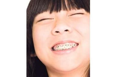 An Orthodontist’s Tips on Braces