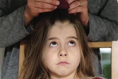 Let’s Talk About Lice